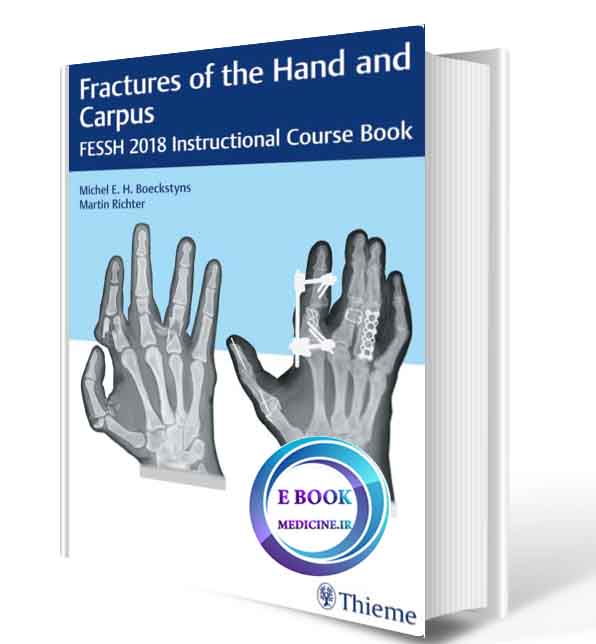 دانلود کتاب Fractures of the Hand and Carpus2018 ( ORIGINAL PDF)